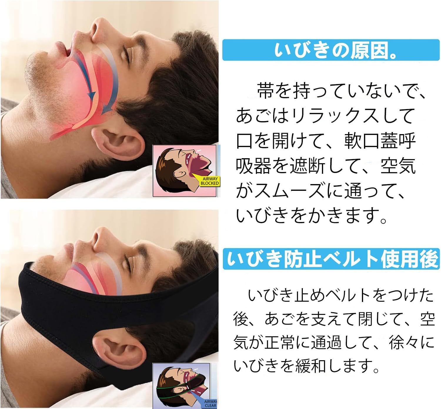 Amazon.co.jp: いびきサポーター, 顎固定ベルト, 口呼吸防止, 睡眠補助